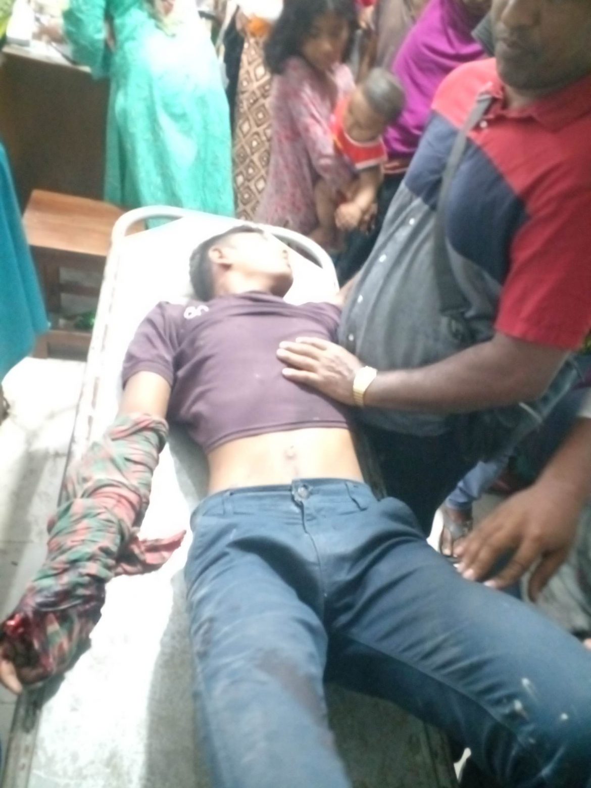 গাংনীতে বেপরোয়া গতির মোটরসাইকেল চালানোর খেসারত