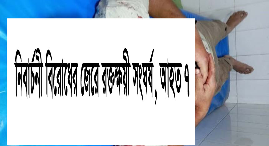 আ. লীগ নেতা ও মুক্তিযোদ্ধা কাশেমের ছেলে লিওন গুরতর জখম