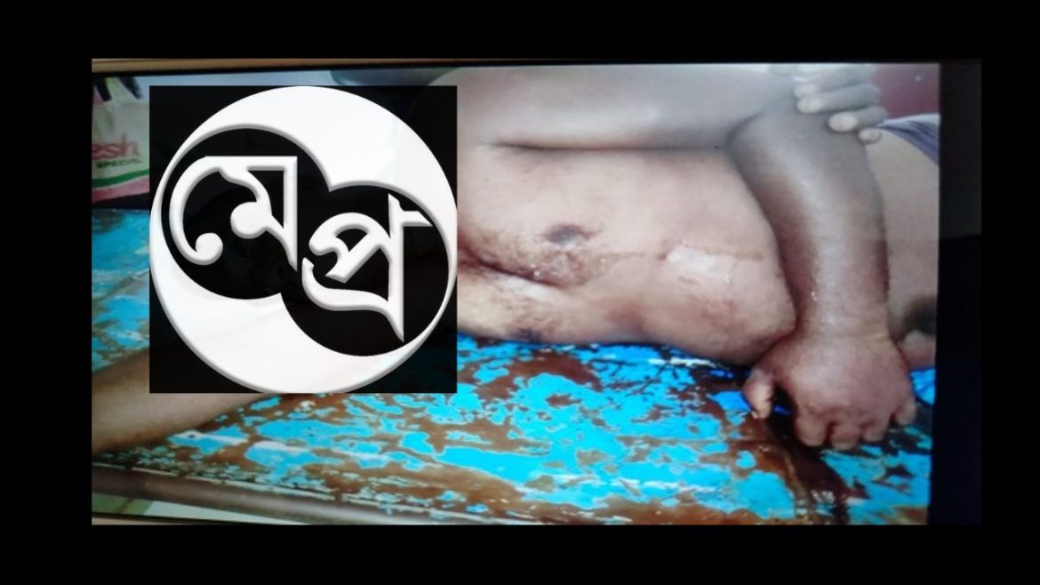 দামুড়হুদার কার্পাসডাঙ্গা মিশনপাড়ায় বিষপানে যুবকের আত্মহত্যা