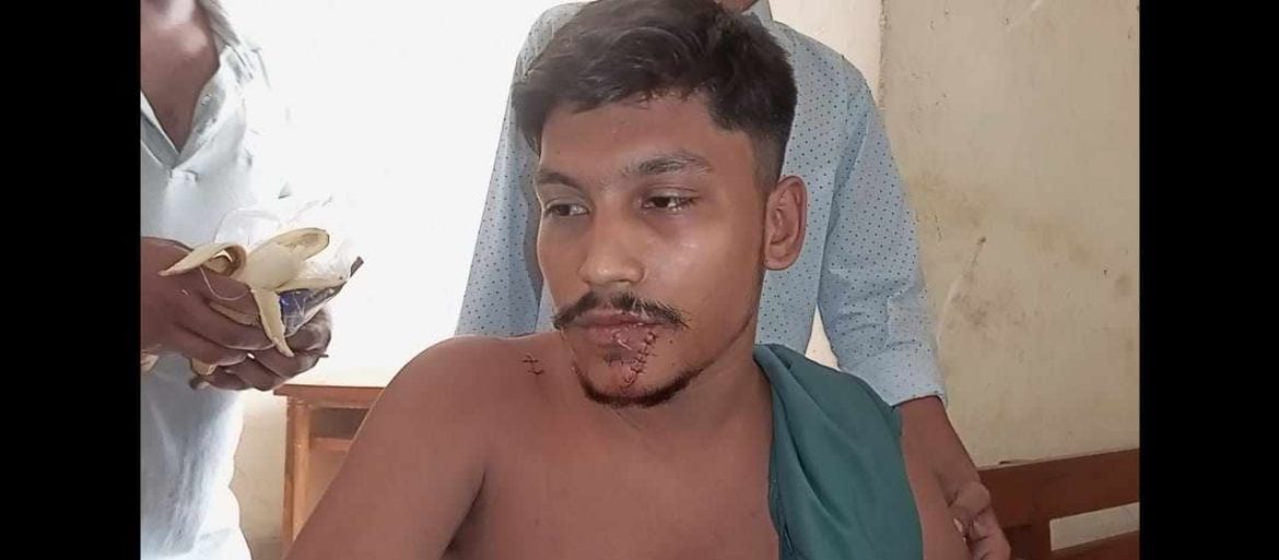 গাংনীতে কলেজ ছাত্রকে খুর চালিয়ে হত্যার চেষ্টা