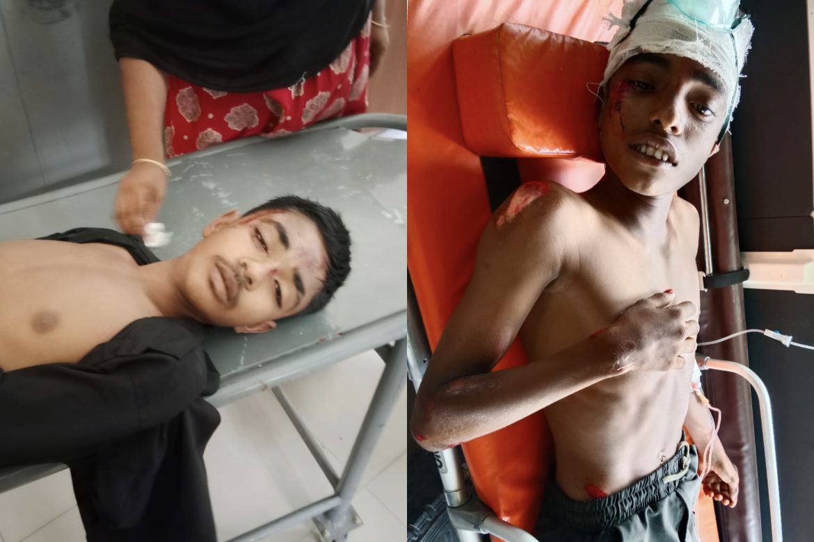 দামুড়হুদার কাঁঠালতলায় সড়ক দুর্ঘটনায় স্কুলছাত্র নিহত, আহত ১