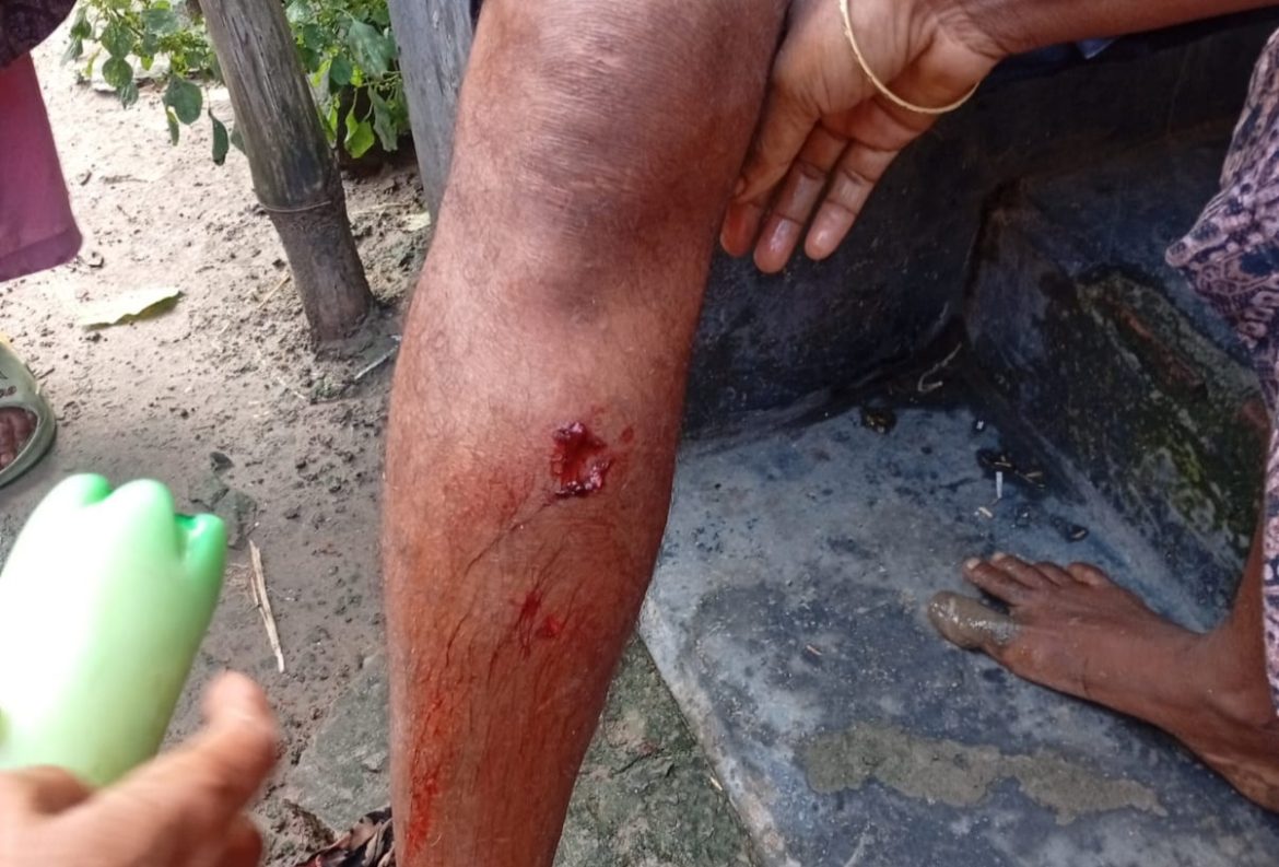 মামলা তুলে নিতে বাদির উপরে সন্ত্রাসী হামলা, পুলিশের সহায়তায় হাসপাতালে ভর্তি